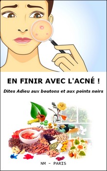 En finir avec l'acné ! Dites adieu aux boutons